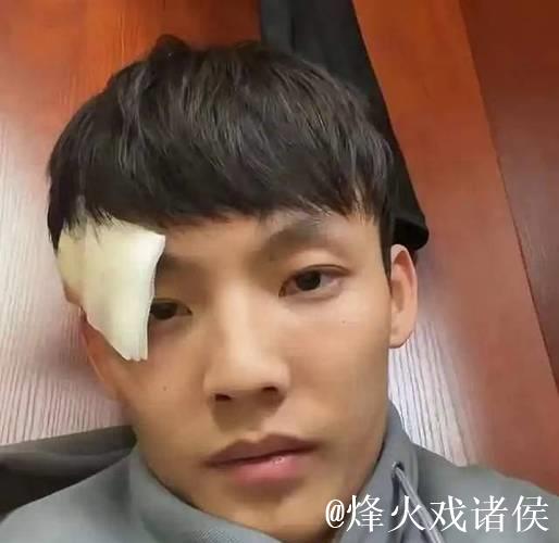 徐杰遭邬挺嘉重伤后首次发声，展现大格局，同曦队高层设宴致歉